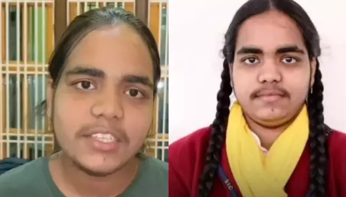 Class 10 Topper, Prachi Nigam SHUTS Trolls Shaming Her For Facial Hair: