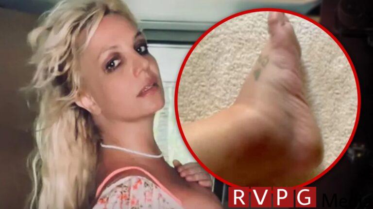 Britney Spears shows off swollen ankle after hotel incident